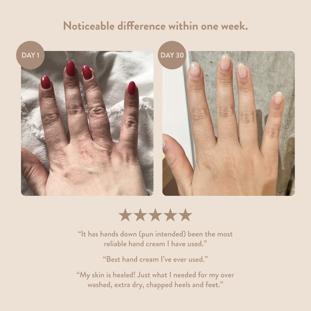 Overnight Hand & Foot Hydration Mask - 1oz