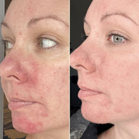 Take Five™ Hypochlorous Acid Balancing Body + Face Spray
