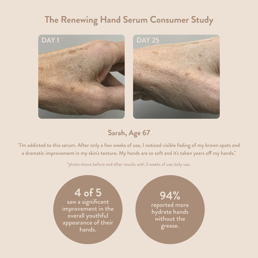 Hand serum consumer study showing before and after effects on a hand with visible skin brightening and reduced dark spots